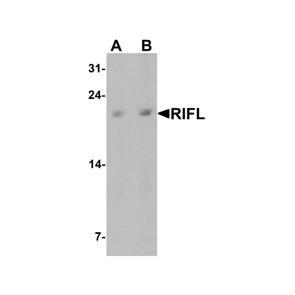 ProSci 7619_S Betatrophin Antibody, ProSci, 0.02 mg/Unit Primary Image
