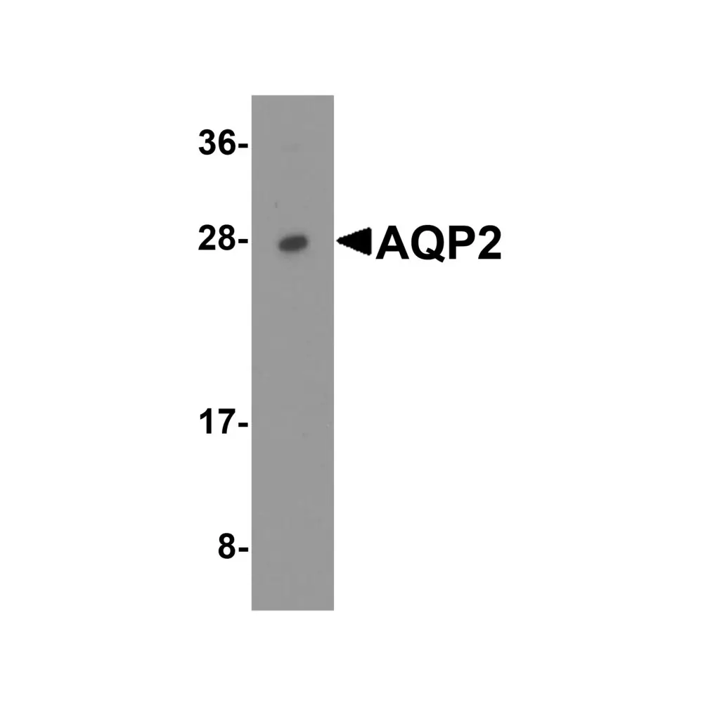 ProSci 7621 AQP2 Antibody, ProSci, 0.1 mg/Unit Primary Image