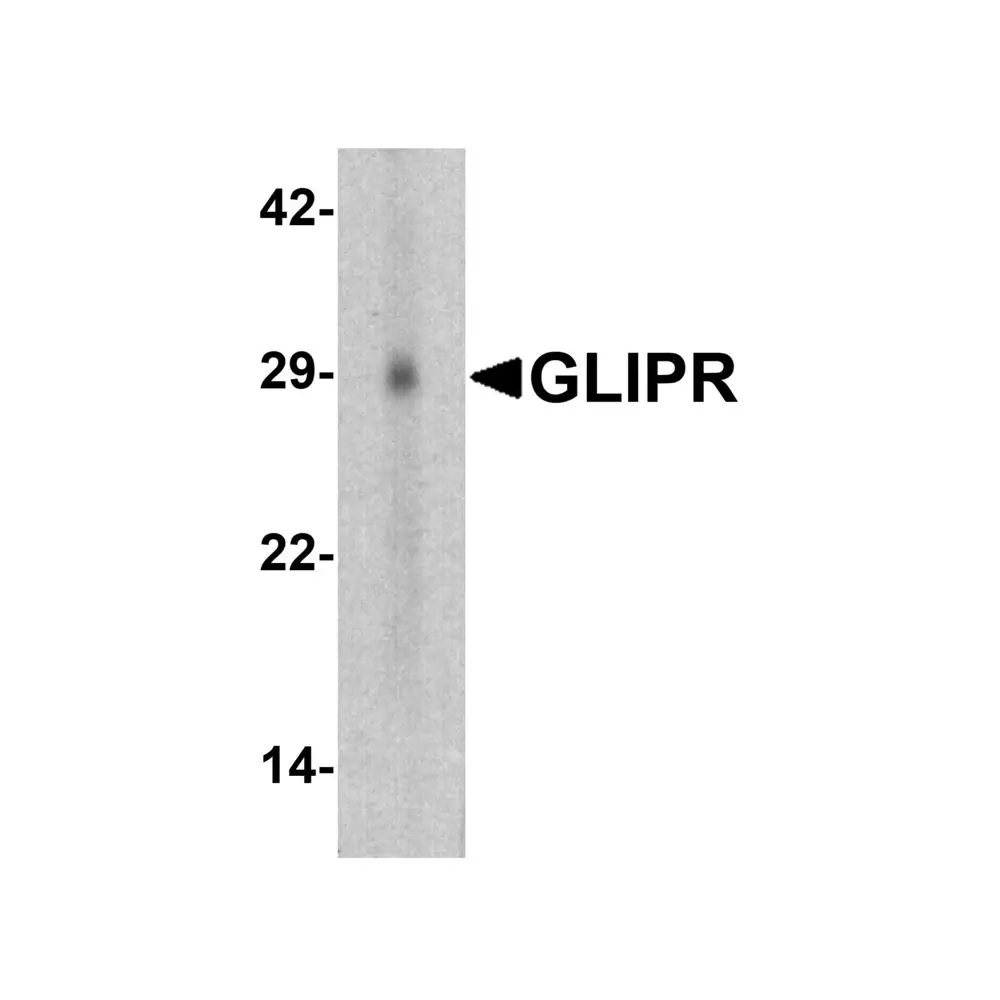 ProSci 7623 GLIPR1 Antibody, ProSci, 0.1 mg/Unit Primary Image