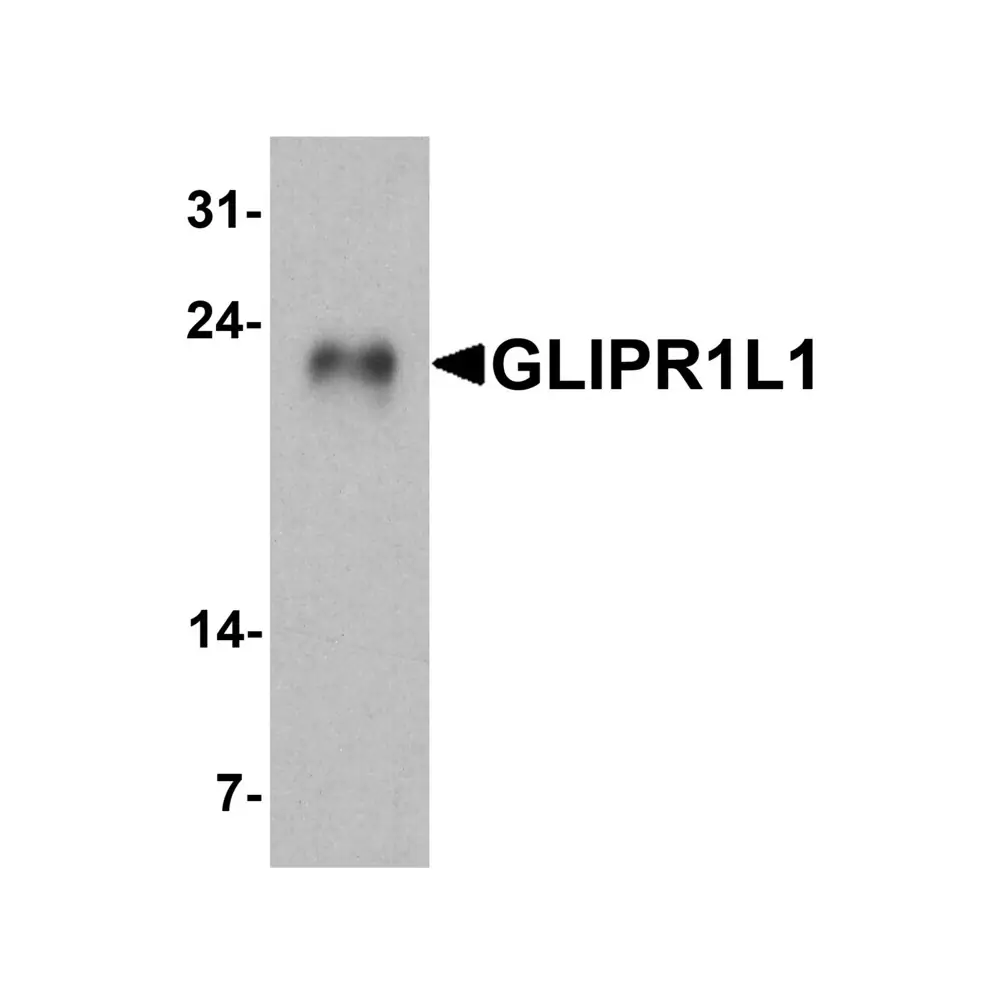 ProSci 7625 GLIPR1L1 Antibody, ProSci, 0.1 mg/Unit Primary Image