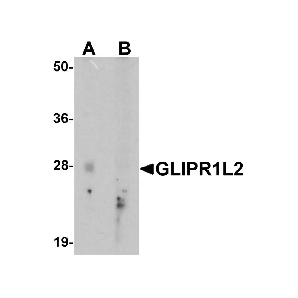 ProSci 7639 GLIPR1L2 Antibody, ProSci, 0.1 mg/Unit Primary Image