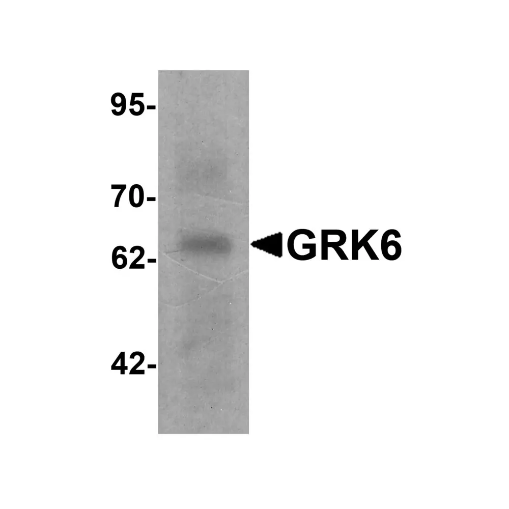 ProSci 7641 GRK6 Antibody, ProSci, 0.1 mg/Unit Primary Image