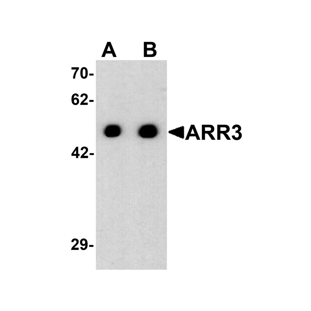 ProSci 7643 ARR3 Antibody, ProSci, 0.1 mg/Unit Primary Image