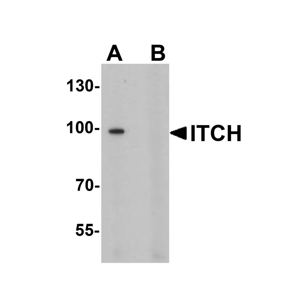 ProSci 7645_S ITCH Antibody, ProSci, 0.02 mg/Unit Primary Image