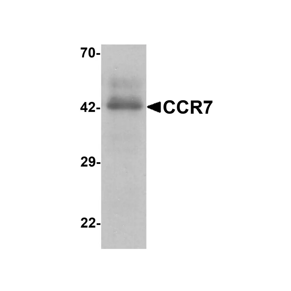 ProSci 7649_S CCR7 Antibody, ProSci, 0.02 mg/Unit Primary Image