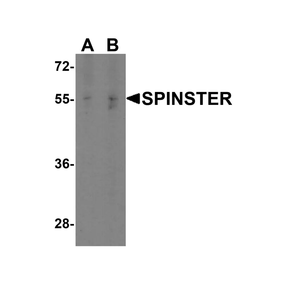 ProSci 7651 SPINSTER Antibody, ProSci, 0.1 mg/Unit Primary Image