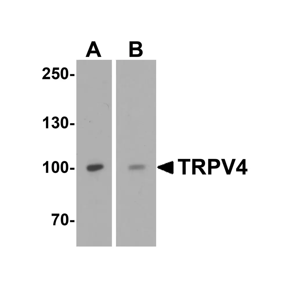 ProSci 7695_S TRPV4 Antibody, ProSci, 0.02 mg/Unit Primary Image
