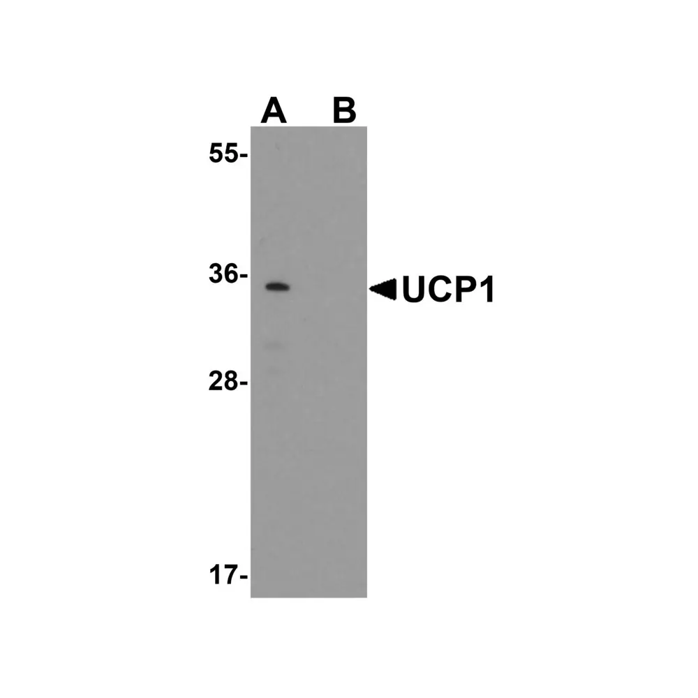ProSci 7697 UCP1 Antibody, ProSci, 0.1 mg/Unit Primary Image