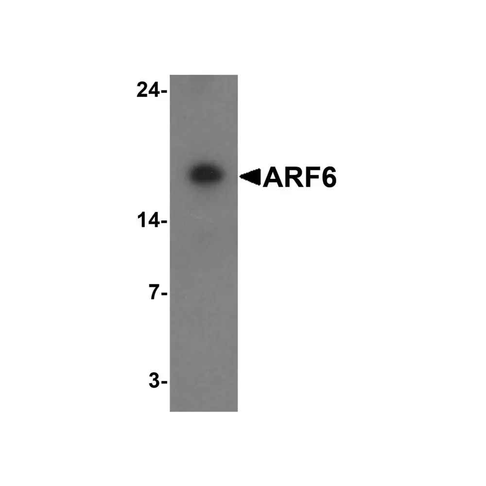 ProSci 7699 ARF6 Antibody, ProSci, 0.1 mg/Unit Primary Image