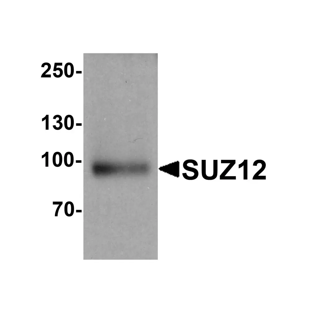 ProSci 7701 SUZ12 Antibody, ProSci, 0.1 mg/Unit Primary Image