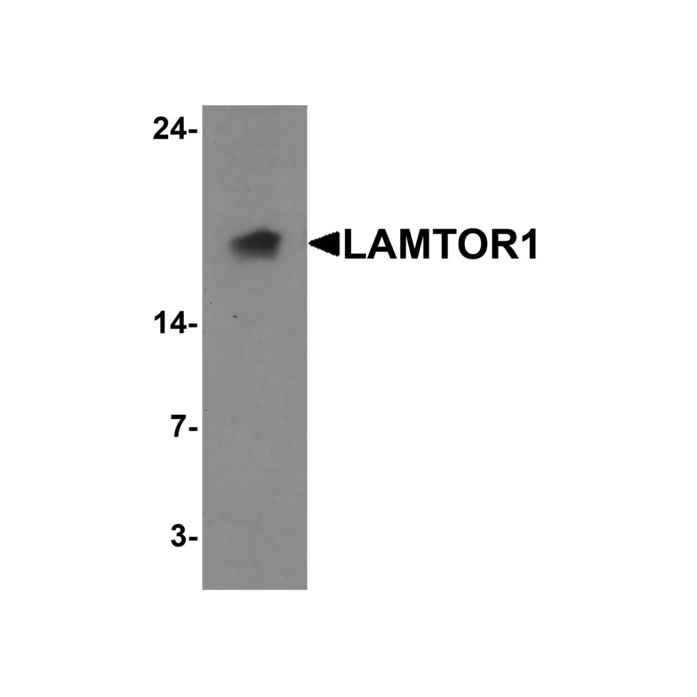 ProSci 7709 LAMTOR1 Antibody, ProSci, 0.1 mg/Unit Primary Image