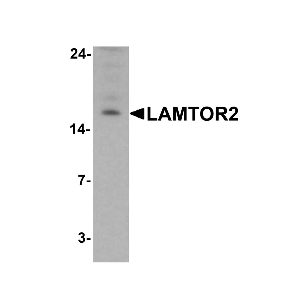 ProSci 7711 LAMTOR2 Antibody, ProSci, 0.1 mg/Unit Primary Image