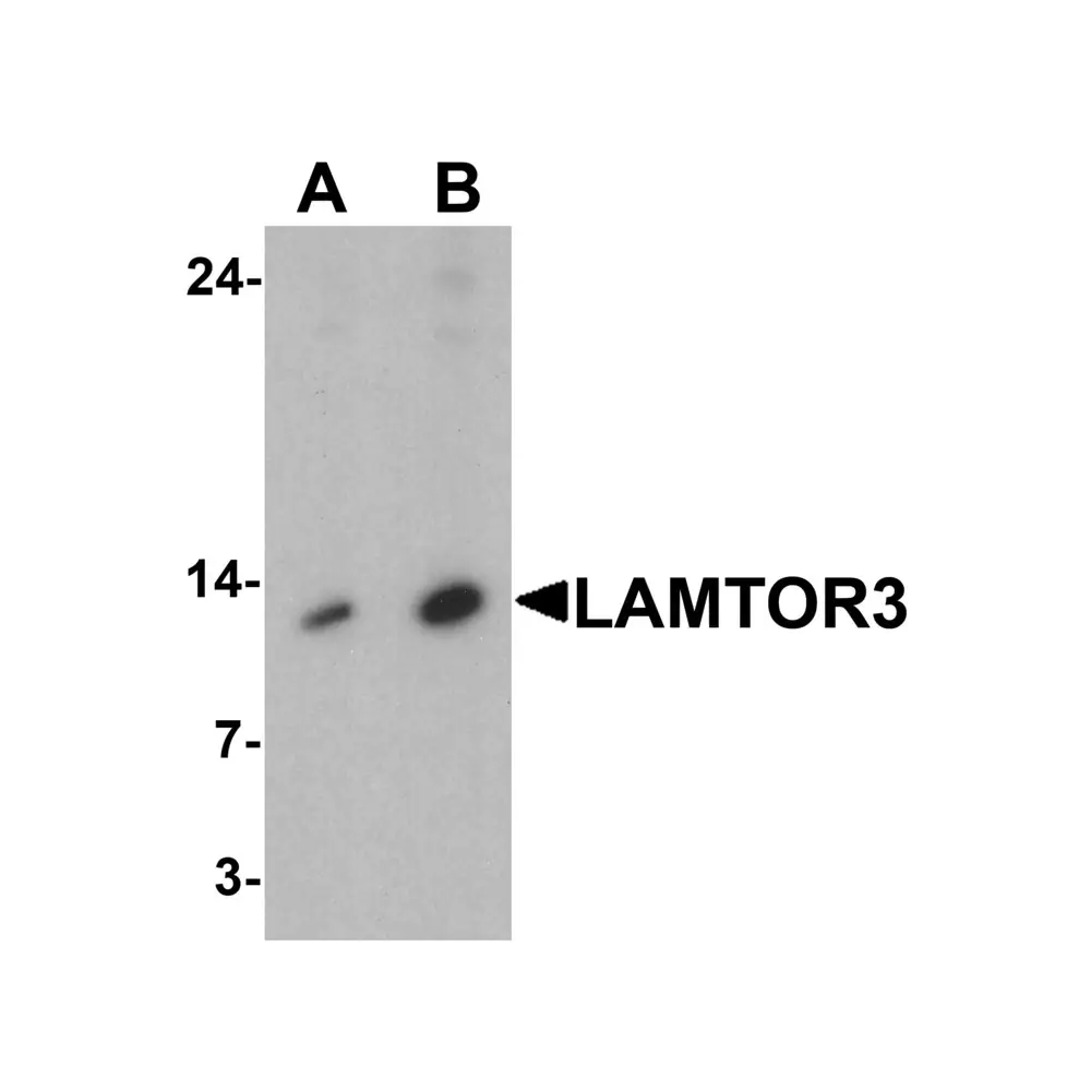 ProSci 7713 LAMTOR3 Antibody, ProSci, 0.1 mg/Unit Primary Image