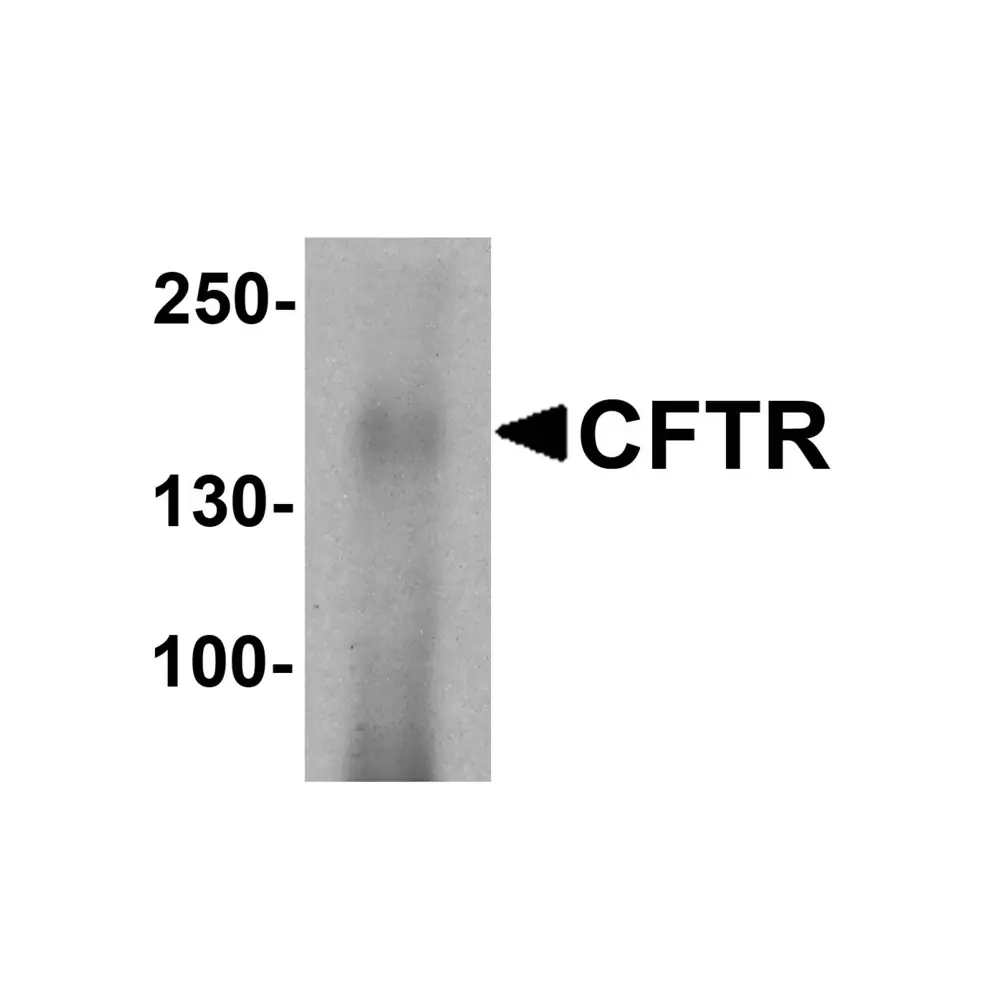 ProSci 7717 CFTR Antibody, ProSci, 0.1 mg/Unit Primary Image