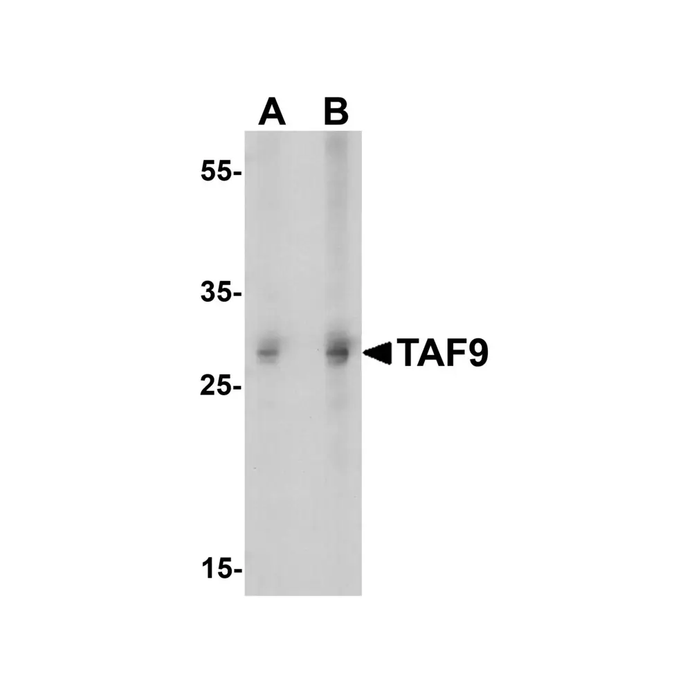 ProSci 7719 TAF9 Antibody, ProSci, 0.1 mg/Unit Primary Image