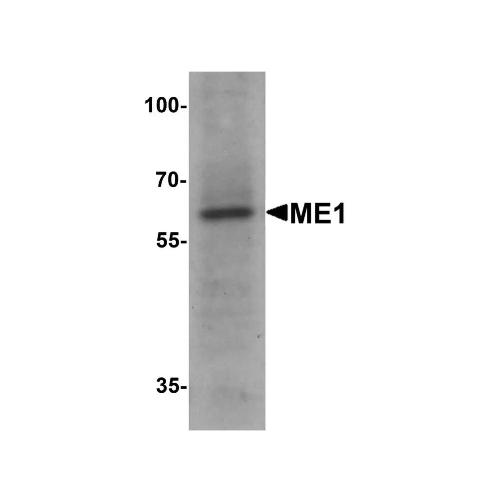 ProSci 7721 ME1 Antibody, ProSci, 0.1 mg/Unit Primary Image