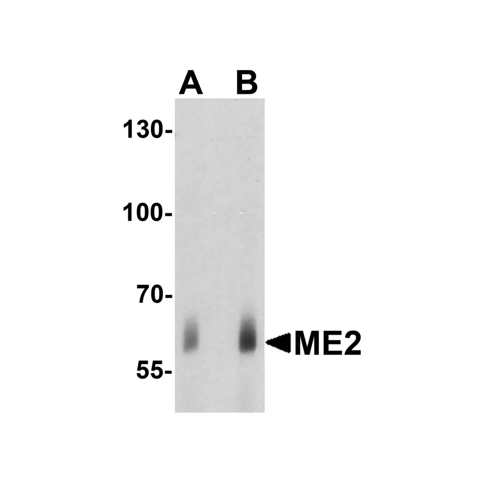 ProSci 7723_S ME2 Antibody, ProSci, 0.02 mg/Unit Primary Image