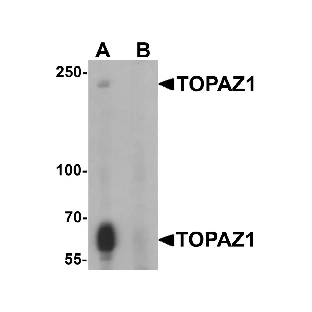 ProSci 7737 TOPAZ1 Antibody, ProSci, 0.1 mg/Unit Primary Image