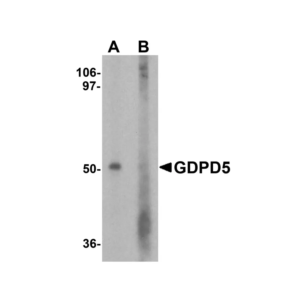ProSci 7739 GDPD5 Antibody, ProSci, 0.1 mg/Unit Primary Image