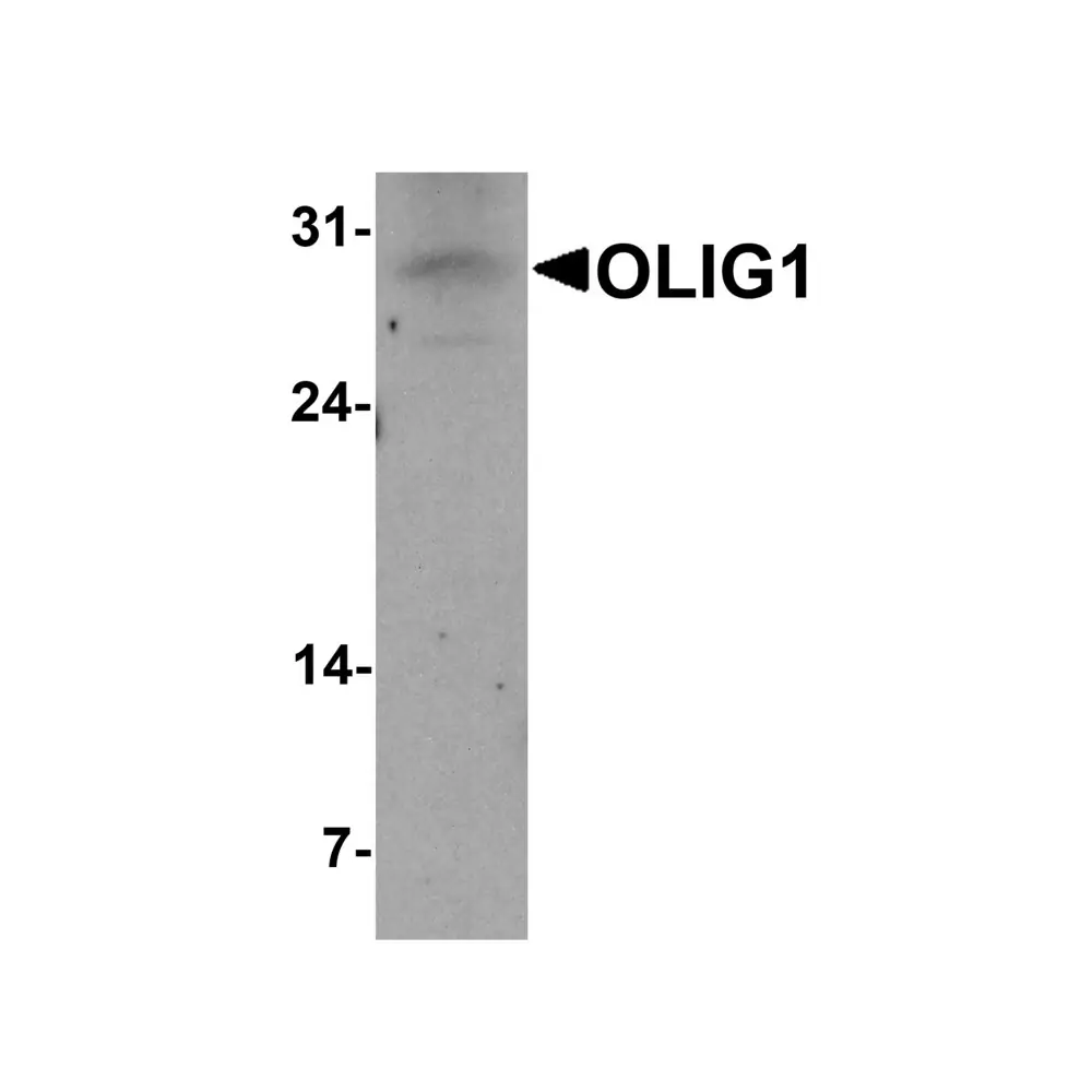 ProSci 7741 OLIG1 Antibody, ProSci, 0.1 mg/Unit Primary Image