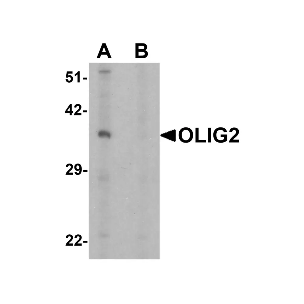 ProSci 7743 OLIG2 Antibody, ProSci, 0.1 mg/Unit Primary Image