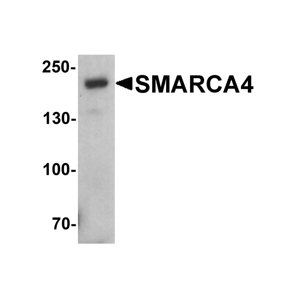 ProSci 7749_S SMARCA4 Antibody, ProSci, 0.02 mg/Unit Primary Image