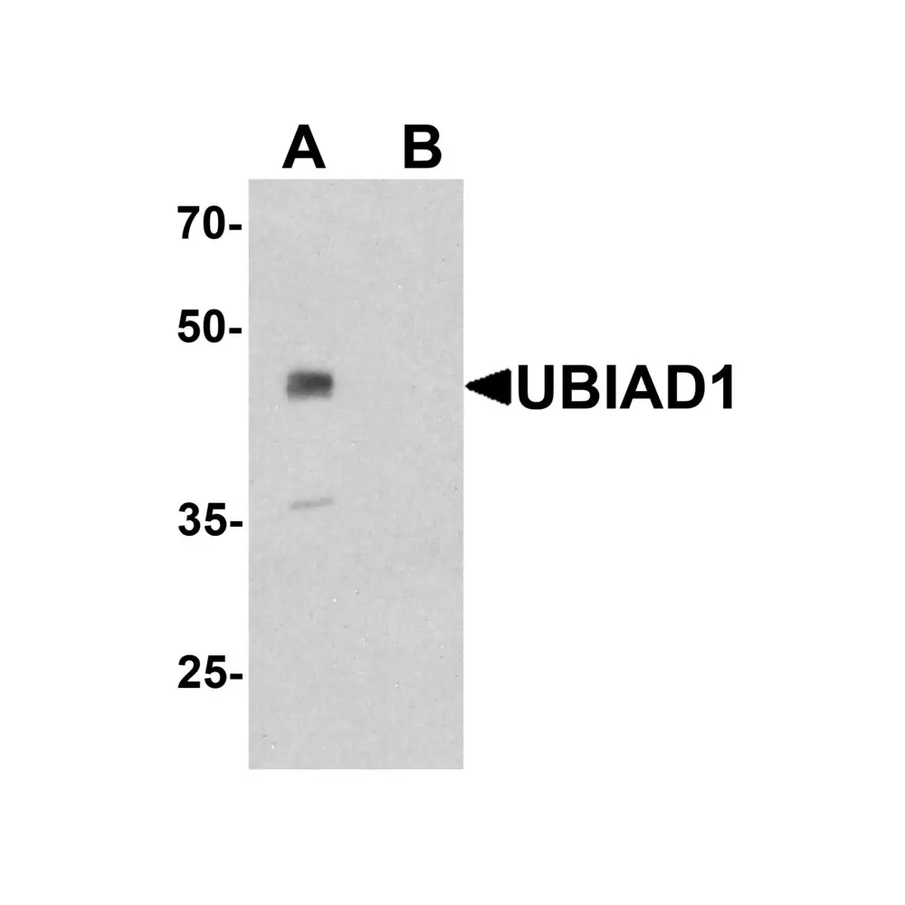 ProSci 7751_S UBIAD1 Antibody, ProSci, 0.02 mg/Unit Primary Image