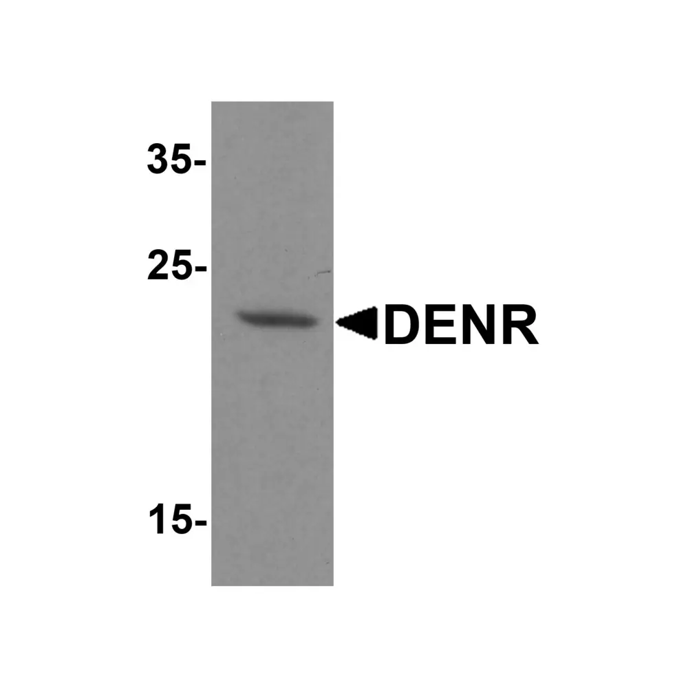 ProSci 7755_S DENR Antibody, ProSci, 0.02 mg/Unit Primary Image