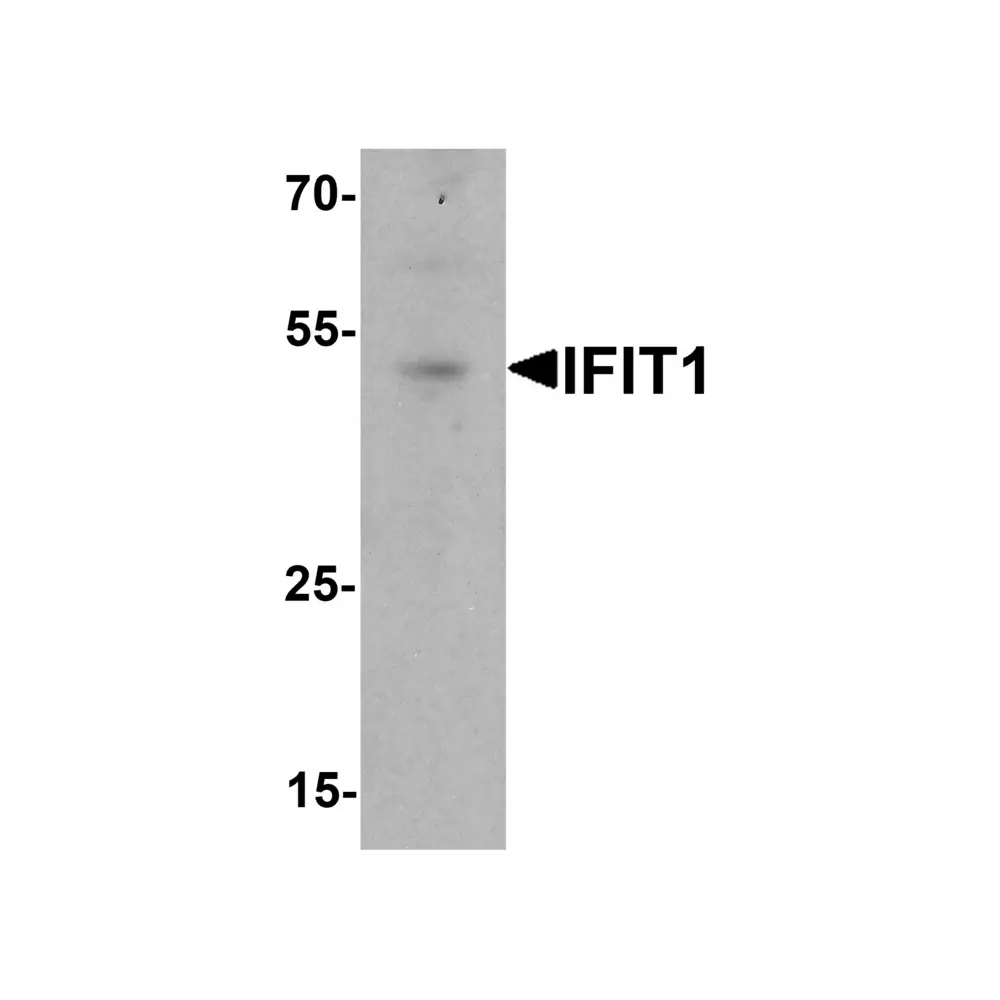 ProSci 7757 IFIT1 Antibody, ProSci, 0.1 mg/Unit Primary Image