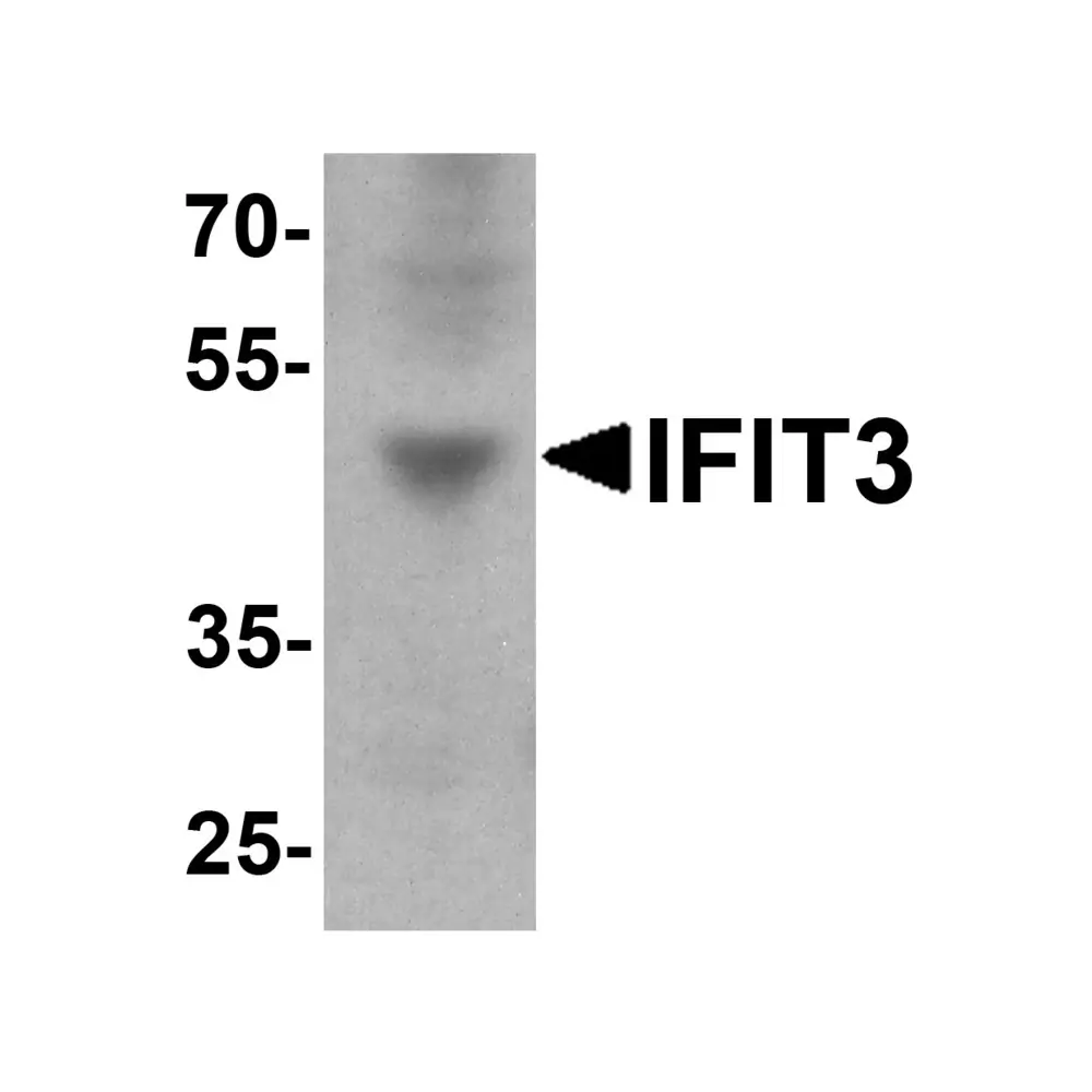 ProSci 7759 IFIT3 Antibody , ProSci, 0.1 mg/Unit Primary Image