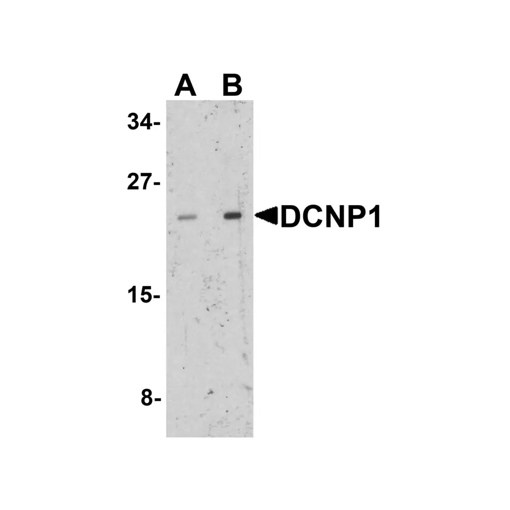 ProSci 7769 DCNP1 Antibody, ProSci, 0.1 mg/Unit Primary Image