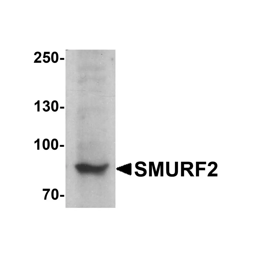 ProSci 7773 SMURF2 Antibody, ProSci, 0.1 mg/Unit Primary Image