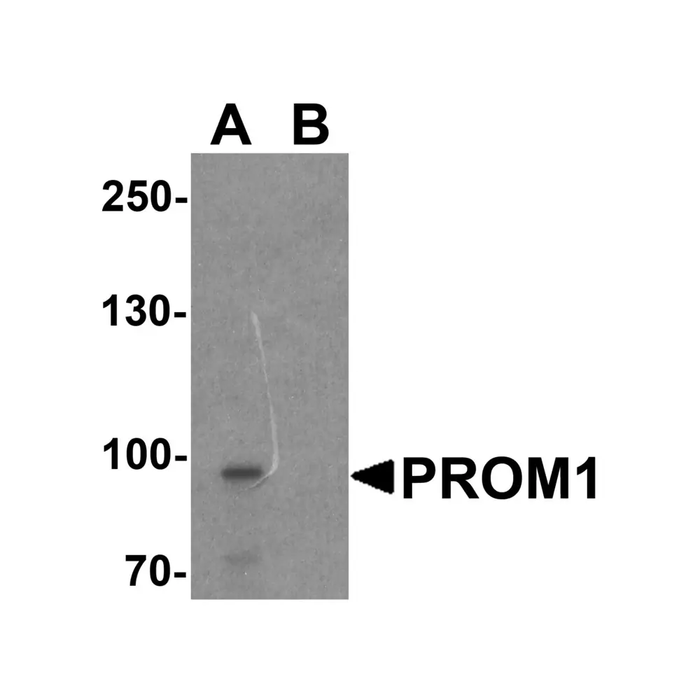 ProSci 7783 PROM1 Antibody, ProSci, 0.1 mg/Unit Primary Image