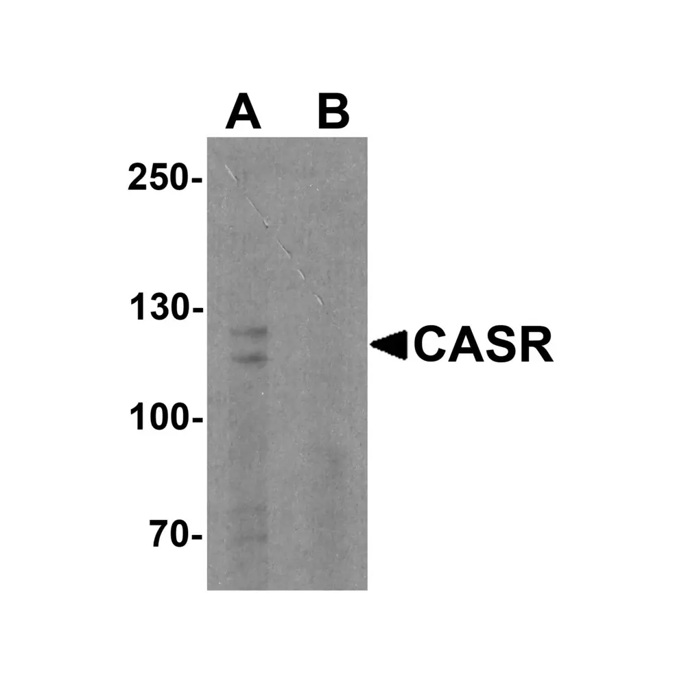 ProSci 7785 CASR Antibody, ProSci, 0.1 mg/Unit Primary Image
