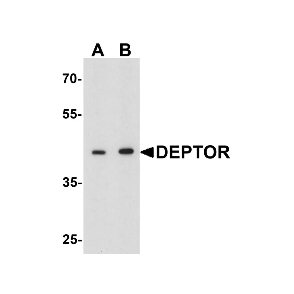 ProSci 7787_S DEPTOR Antibody, ProSci, 0.02 mg/Unit Primary Image