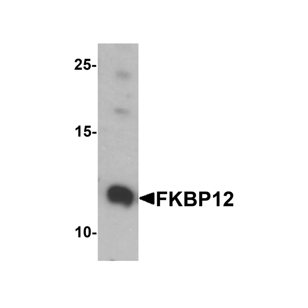 ProSci 7789_S FKBP12 Antibody, ProSci, 0.02 mg/Unit Primary Image