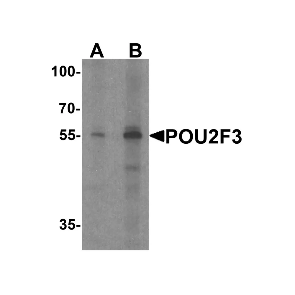 ProSci 7795 POU2F3 Antibody, ProSci, 0.1 mg/Unit Primary Image