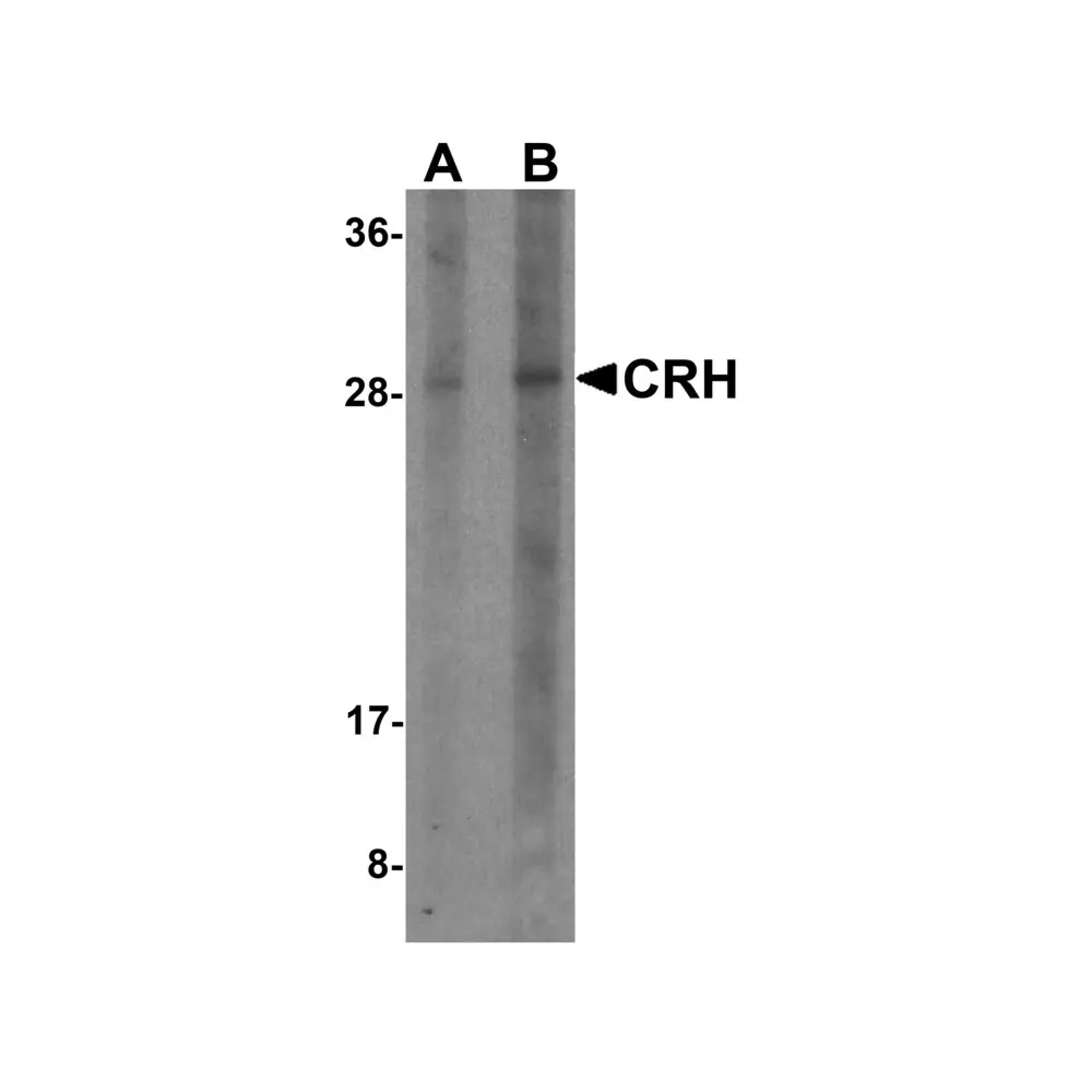 ProSci 7797 CRH Antibody, ProSci, 0.1 mg/Unit Primary Image