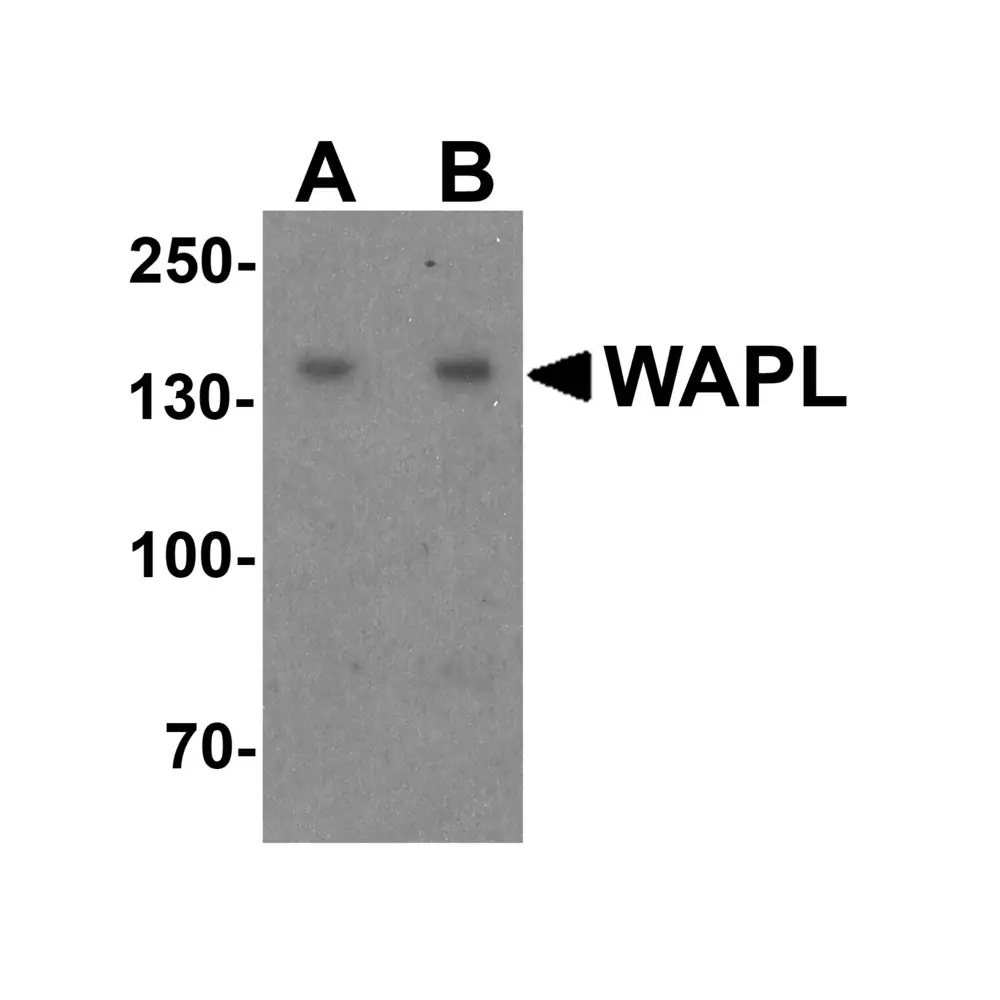 ProSci 7799 WAPL Antibody, ProSci, 0.1 mg/Unit Primary Image