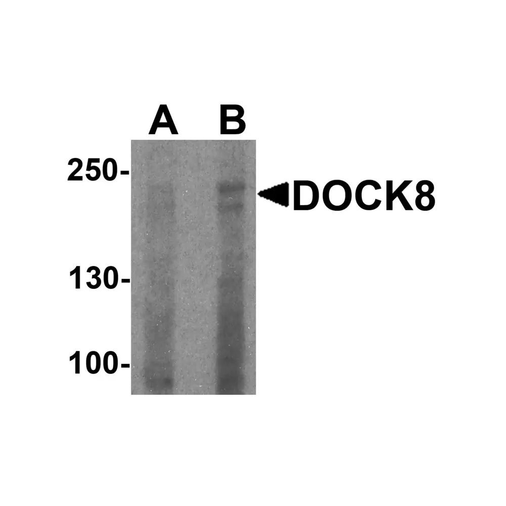ProSci 7847 DOCK8 Antibody, ProSci, 0.1 mg/Unit Primary Image