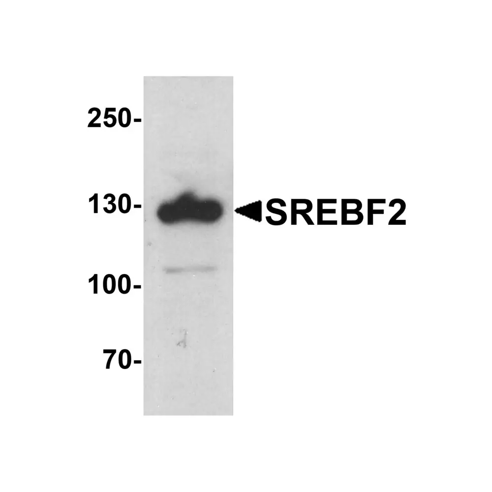 ProSci 7855_S SREBF2 Antibody, ProSci, 0.02 mg/Unit Primary Image