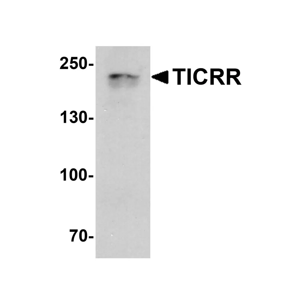 ProSci 7857 TICRR Antibody, ProSci, 0.1 mg/Unit Primary Image