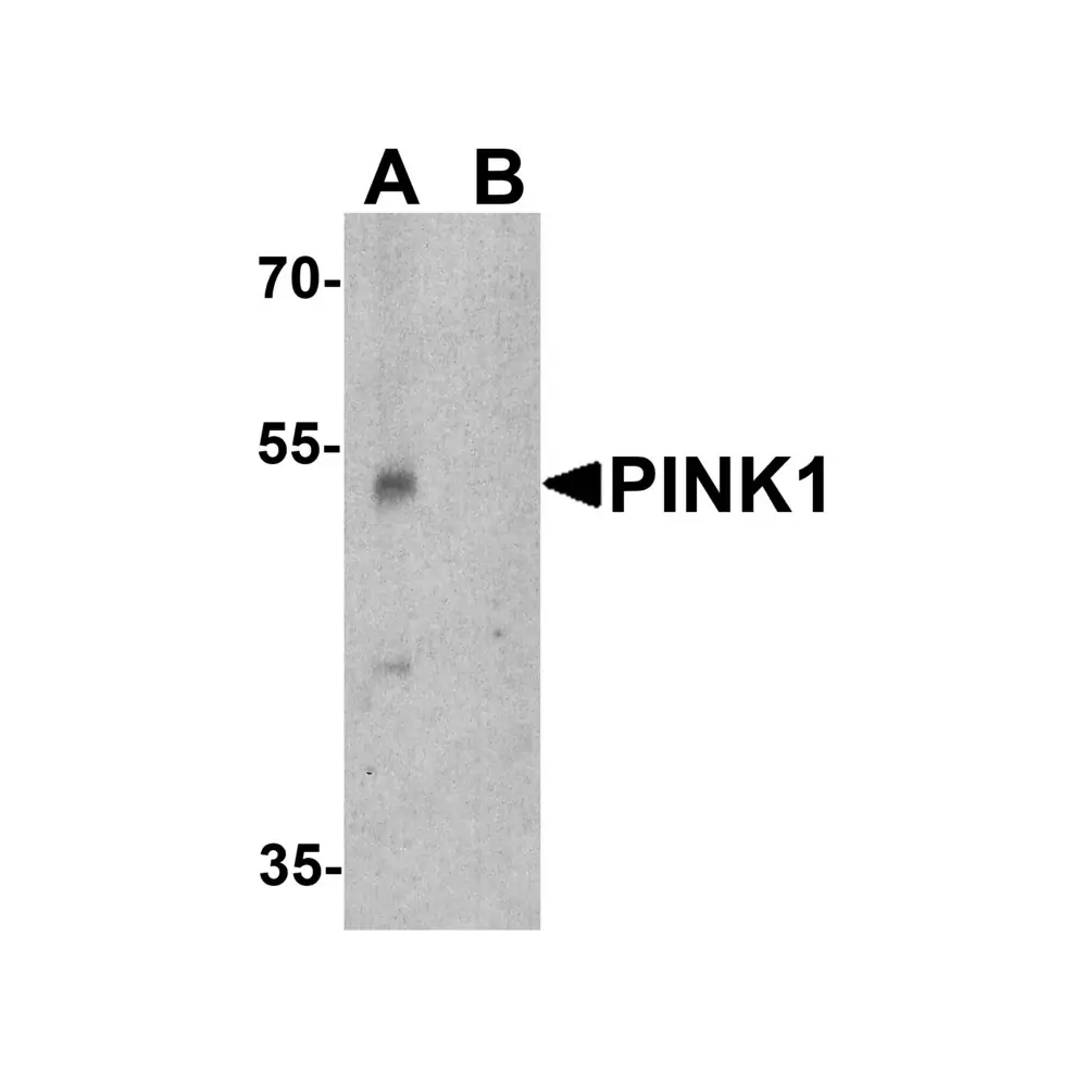 ProSci 7859_S PINK1 Antibody, ProSci, 0.02 mg/Unit Primary Image