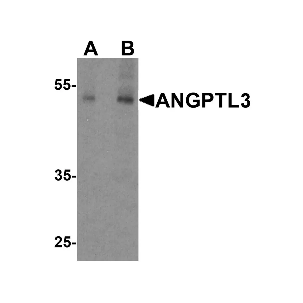 ProSci 7865 ANGPTL3 Antibody, ProSci, 0.1 mg/Unit Primary Image