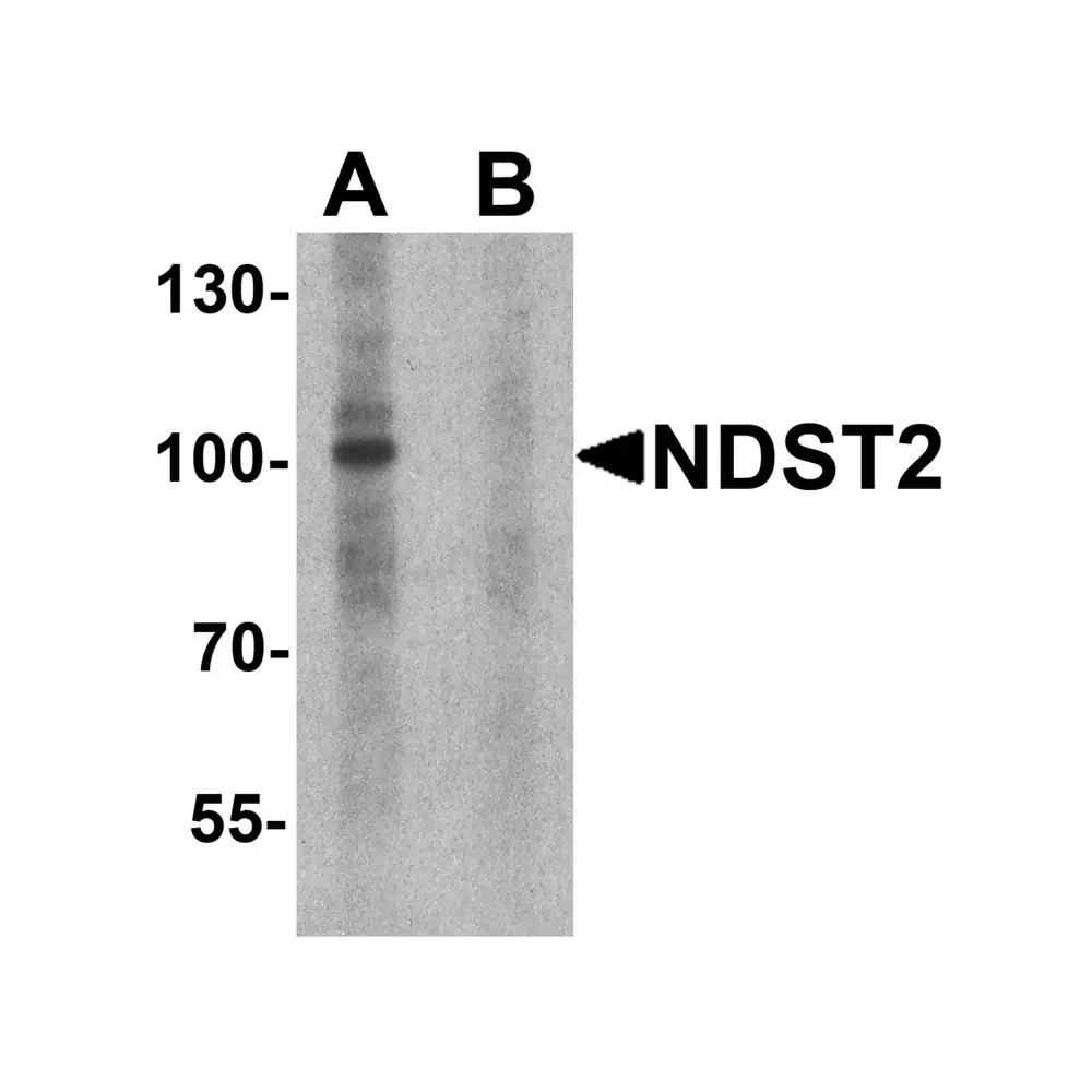 ProSci 7869 NDST2 Antibody, ProSci, 0.1 mg/Unit Primary Image