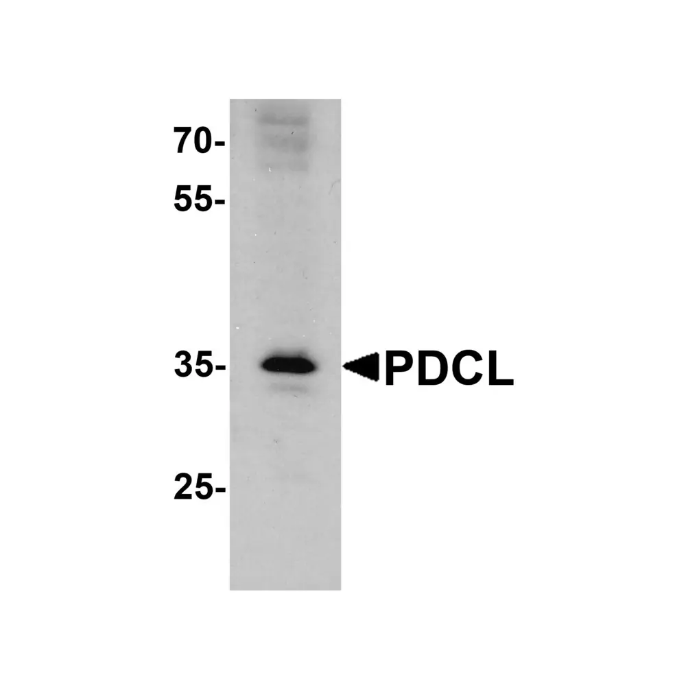 ProSci 7871_S PDCL Antibody, ProSci, 0.02 mg/Unit Primary Image