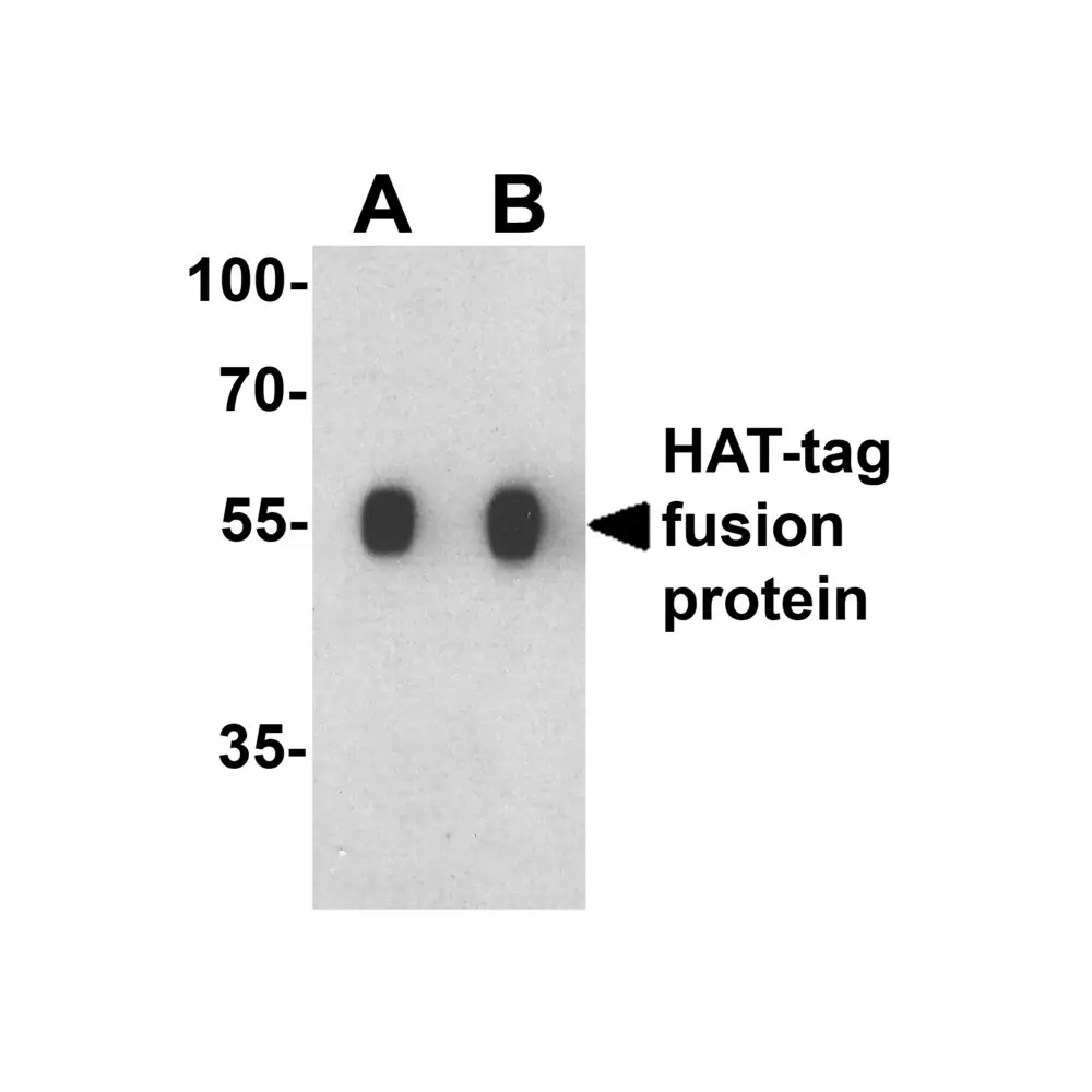 ProSci 7875 HAT-tag Antibody, ProSci, 0.1 mg/Unit Primary Image