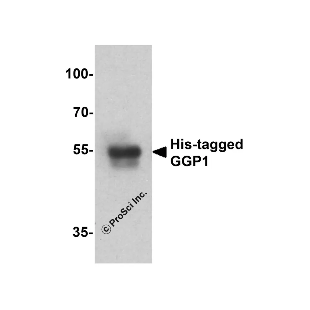 ProSci 7877_S His-tag Antibody, ProSci, 0.02 mg/Unit Secondary Image