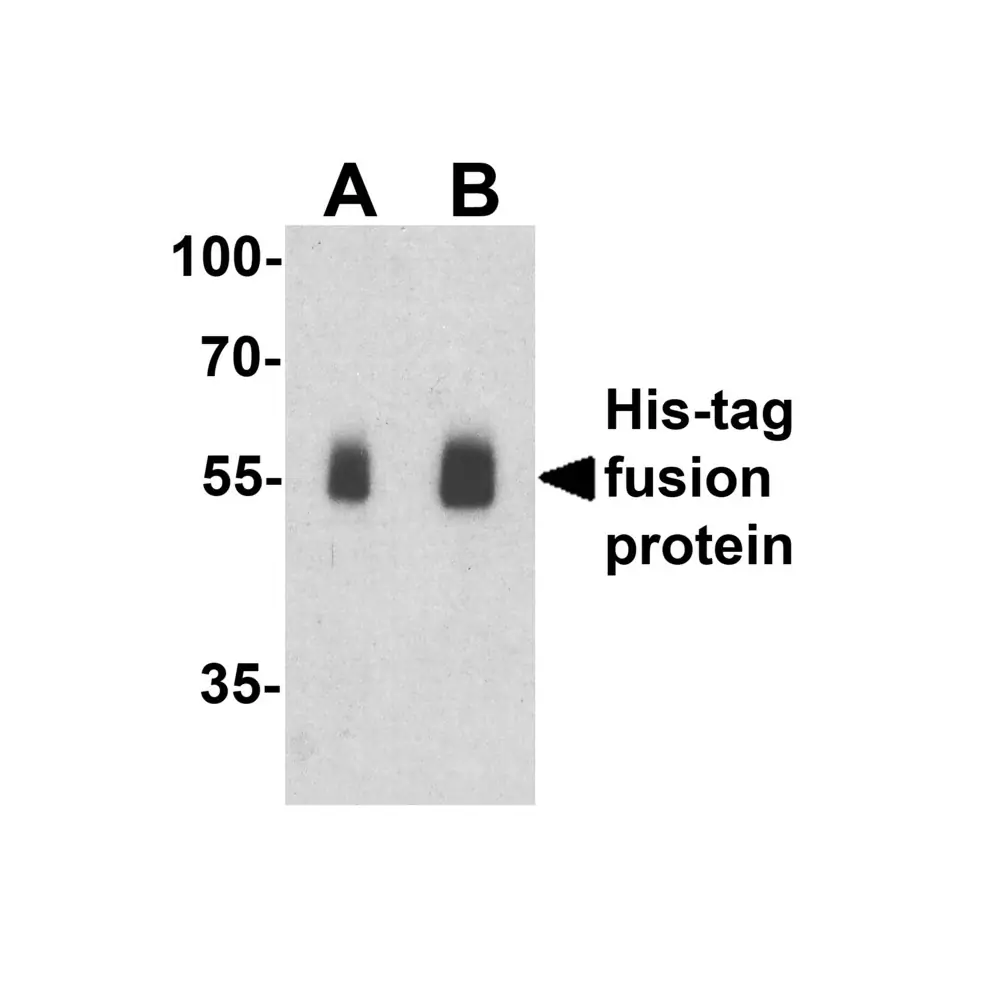 ProSci 7877_S His-tag Antibody, ProSci, 0.02 mg/Unit Primary Image