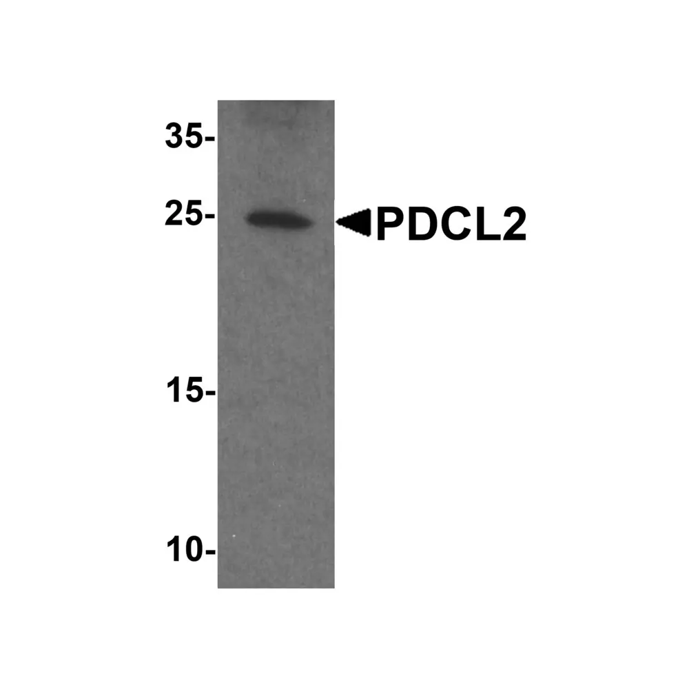 ProSci 7887 PDCL2 Antibody, ProSci, 0.1 mg/Unit Primary Image